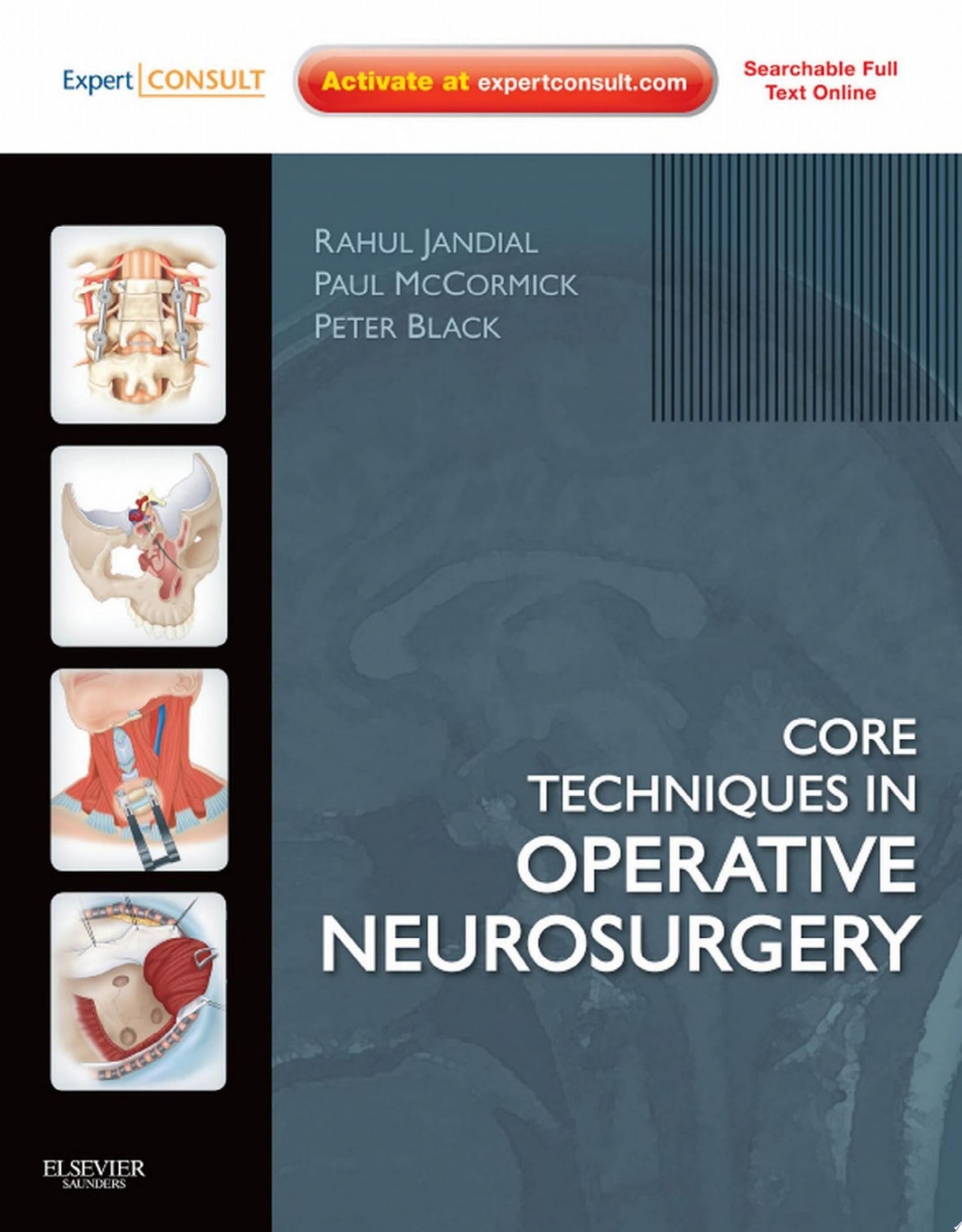 Core Techniques in Operative Neurosurgery: Expert Consult – Online and Print