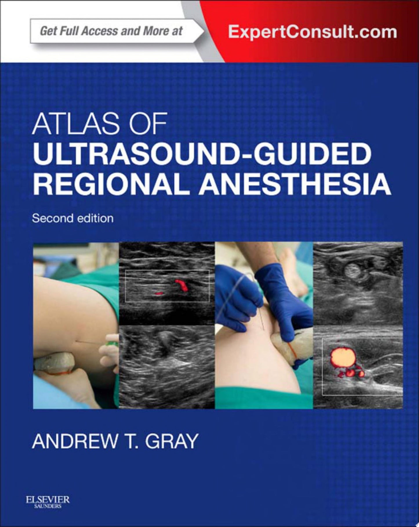 Atlas of Ultrasound-Guided Regional Anesthesia, 2nd Edition