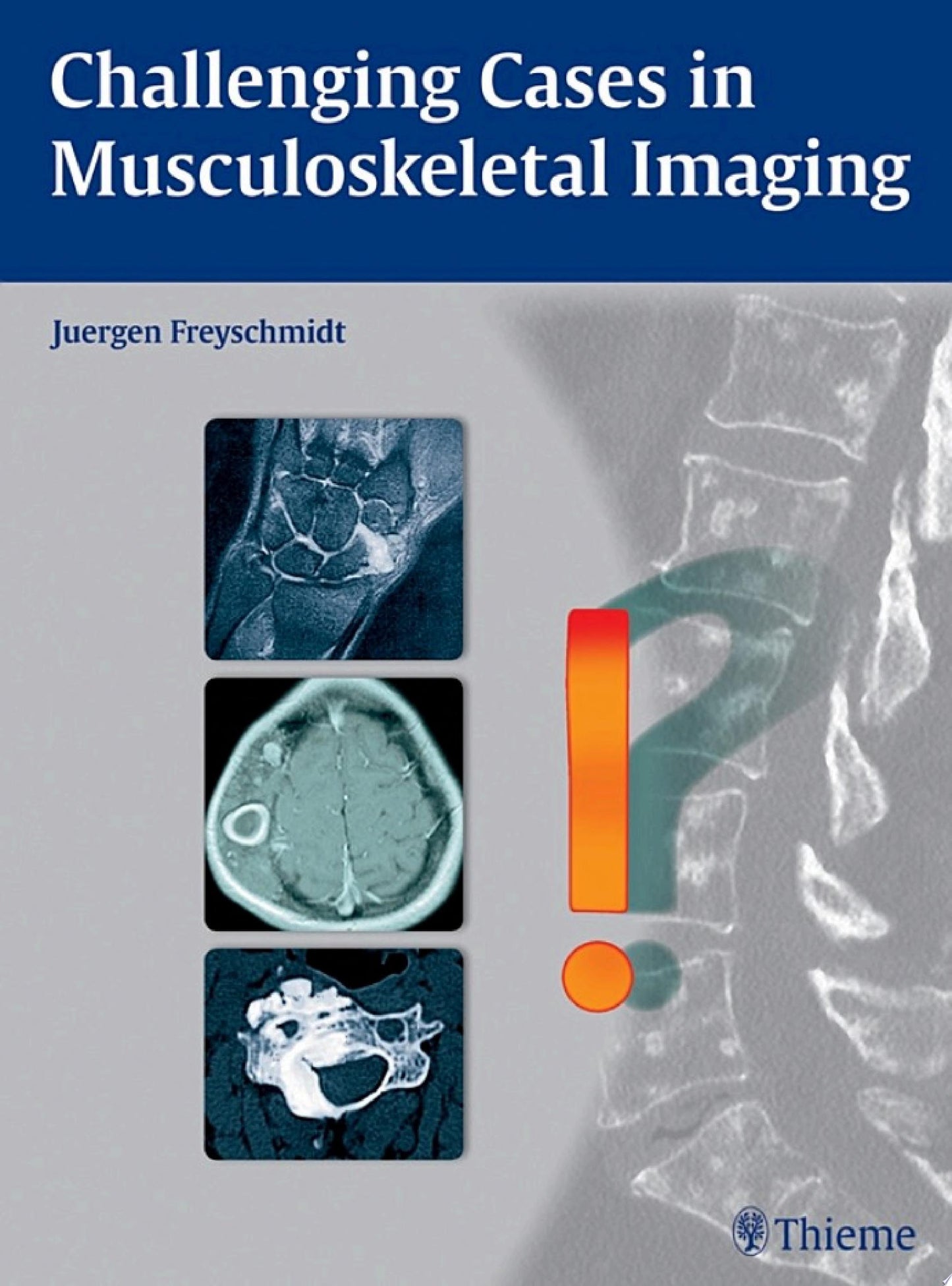Challenging Cases in Musculoskeletal Imaging