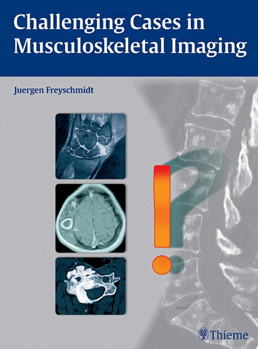 Challenging Cases in Musculoskeletal Imaging