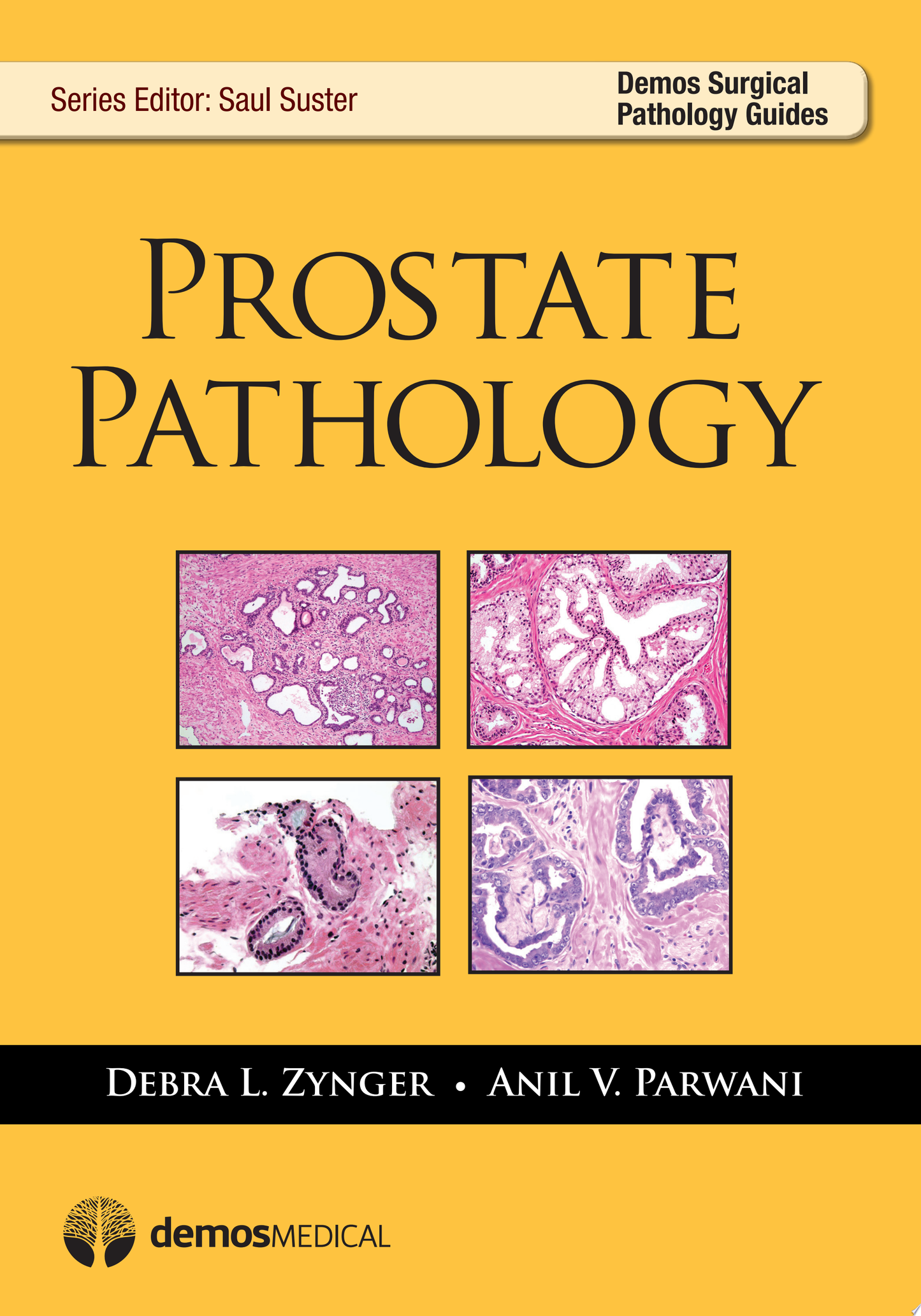 Prostate Pathology