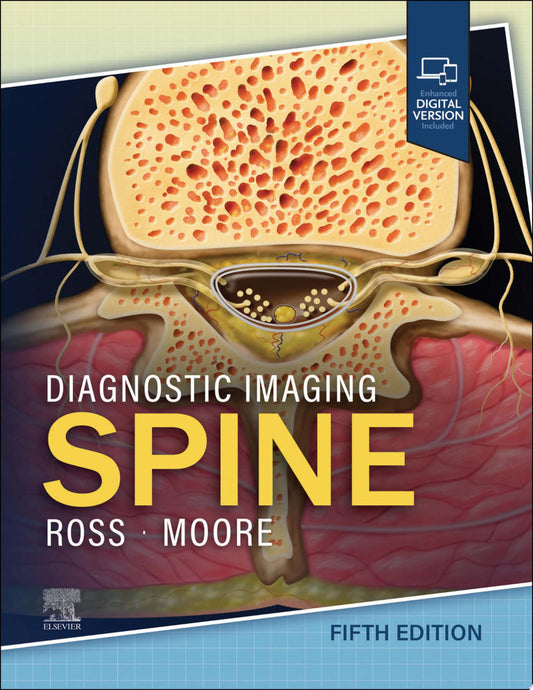 Diagnostic Imaging: Spine, 4th Edition