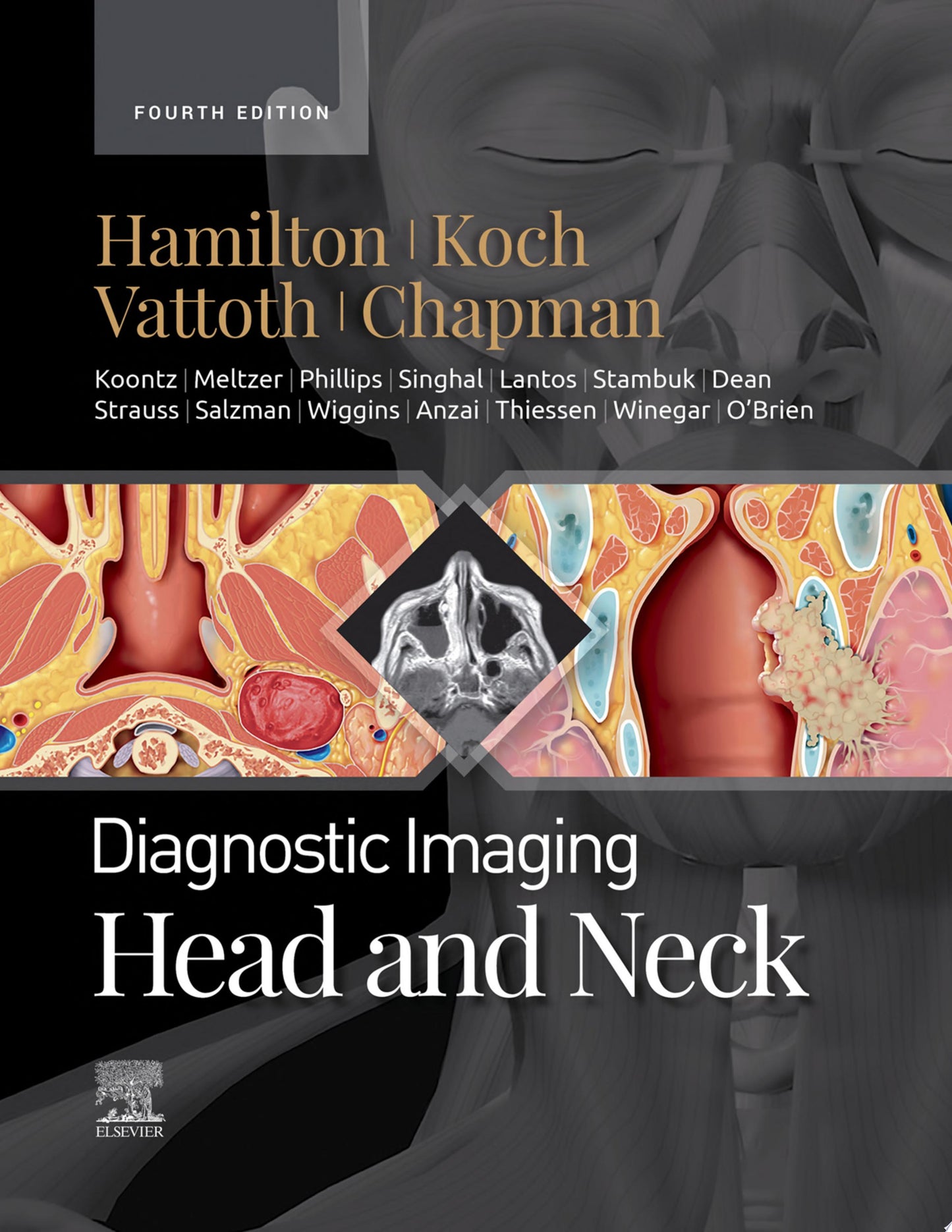 Diagnostic Imaging: Head and Neck, 4th Edition