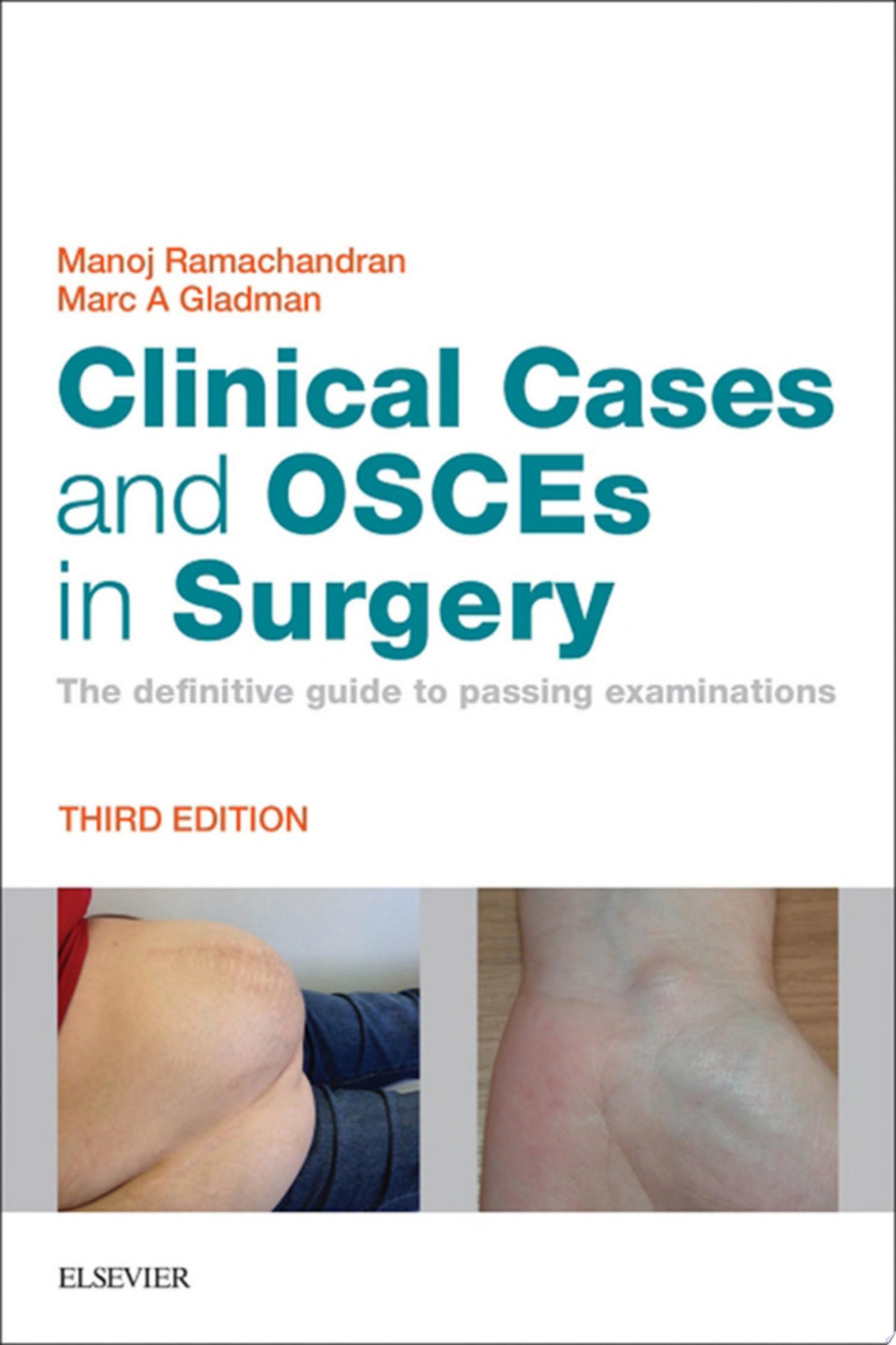Clinical Cases and OSCEs in Surgery: The definitive guide to passing examinations, 3rd edition