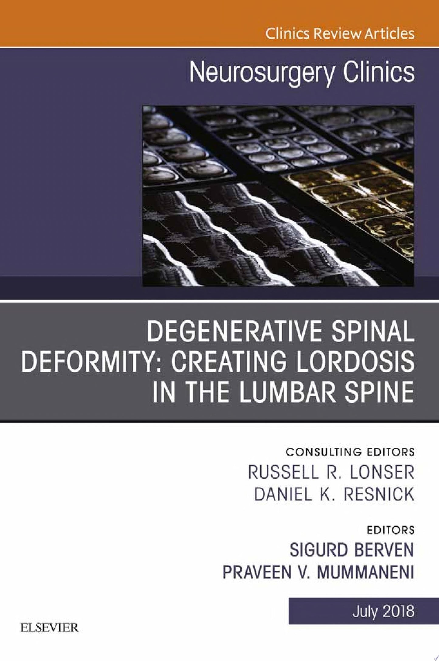 Degenerative Spinal Deformity: Creating Lordosis in the Lumbar Spine, An Issue of Neurosurgery Clinics of North America