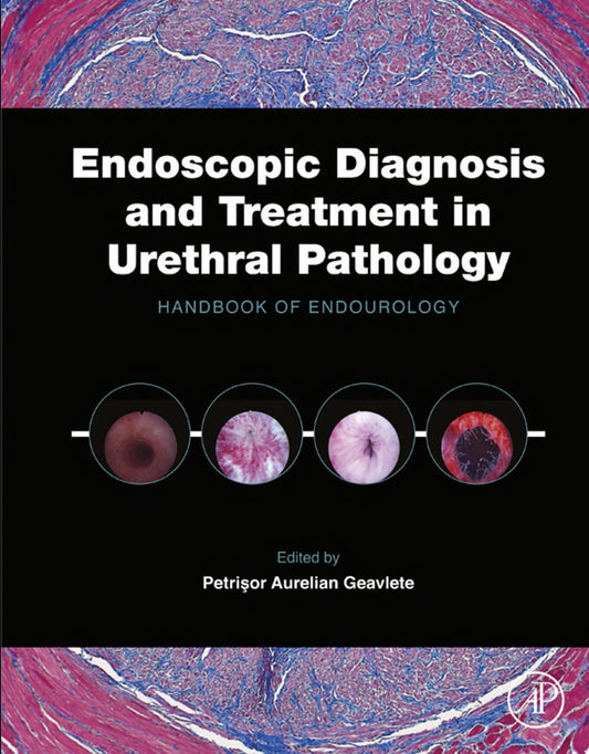 Endoscopic Diagnosis and Treatment in Urethral Pathology: Handbook of Endourology