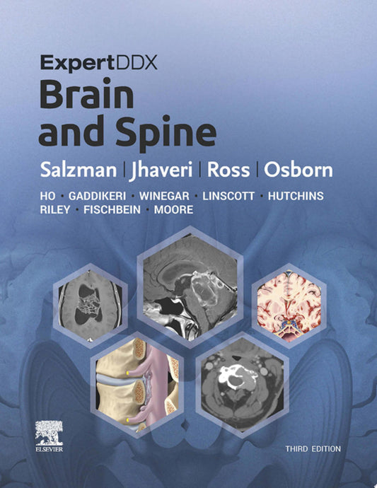 ExpertDDx: Brain and Spine, 2nd Edition