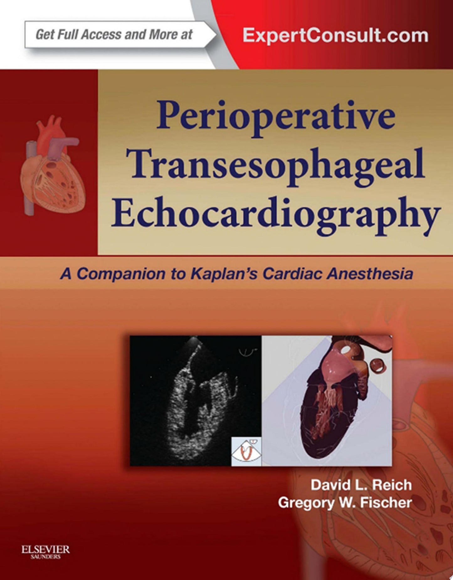 Perioperative Transesophageal Echocardiography: A Companion to Kaplan’s Cardiac Anesthesia