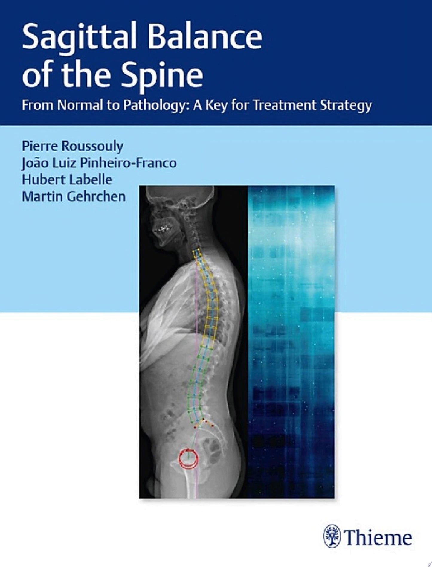Sagittal Balance of the Spine: From Normal to Pathology: A Key for Treatment Strategy