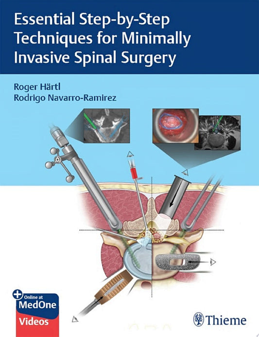 Minimally Invasive Spine Surgery