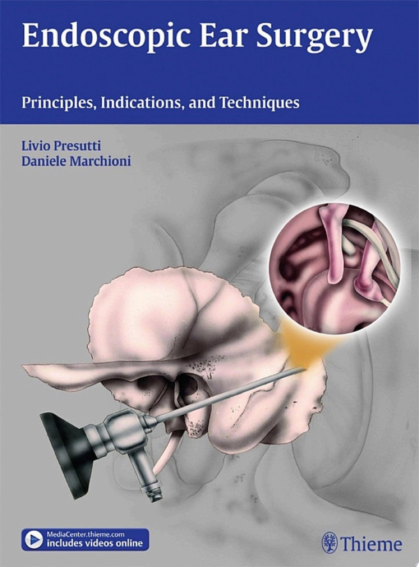 Endoscopic Ear Surgery: Principles, Indications, and Techniques