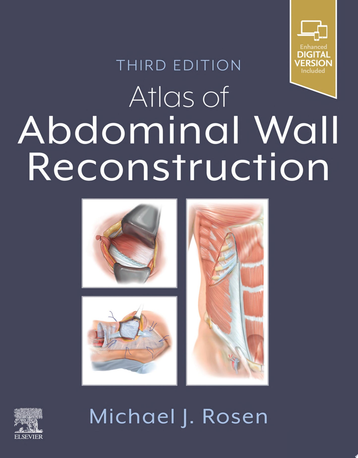 Atlas of Abdominal Wall Reconstruction