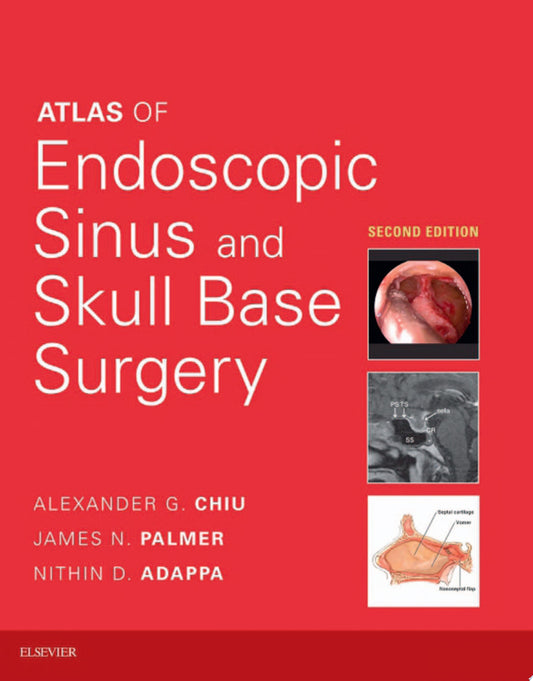 Atlas of Endoscopic Sinus and Skull Base Surgery, 2nd Edition