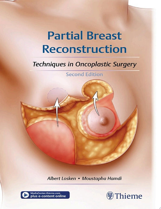 Partial Breast Reconstruction: Techniques in Oncoplastic Surgery, 2nd Edition