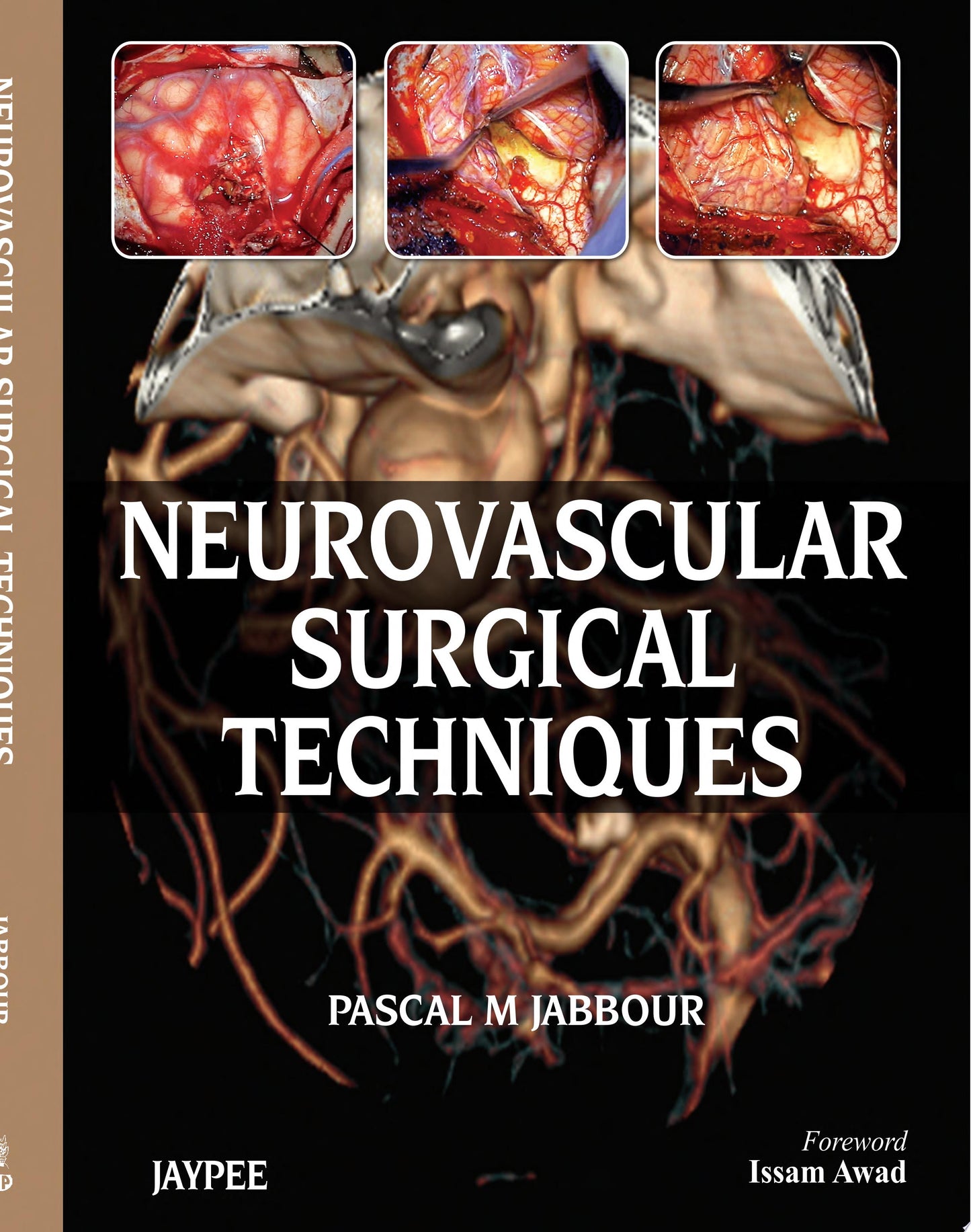 Neurovascular Surgical Techniques