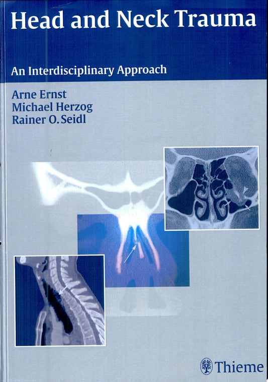 Head and Neck Trauma: An Interdisciplinary Approach