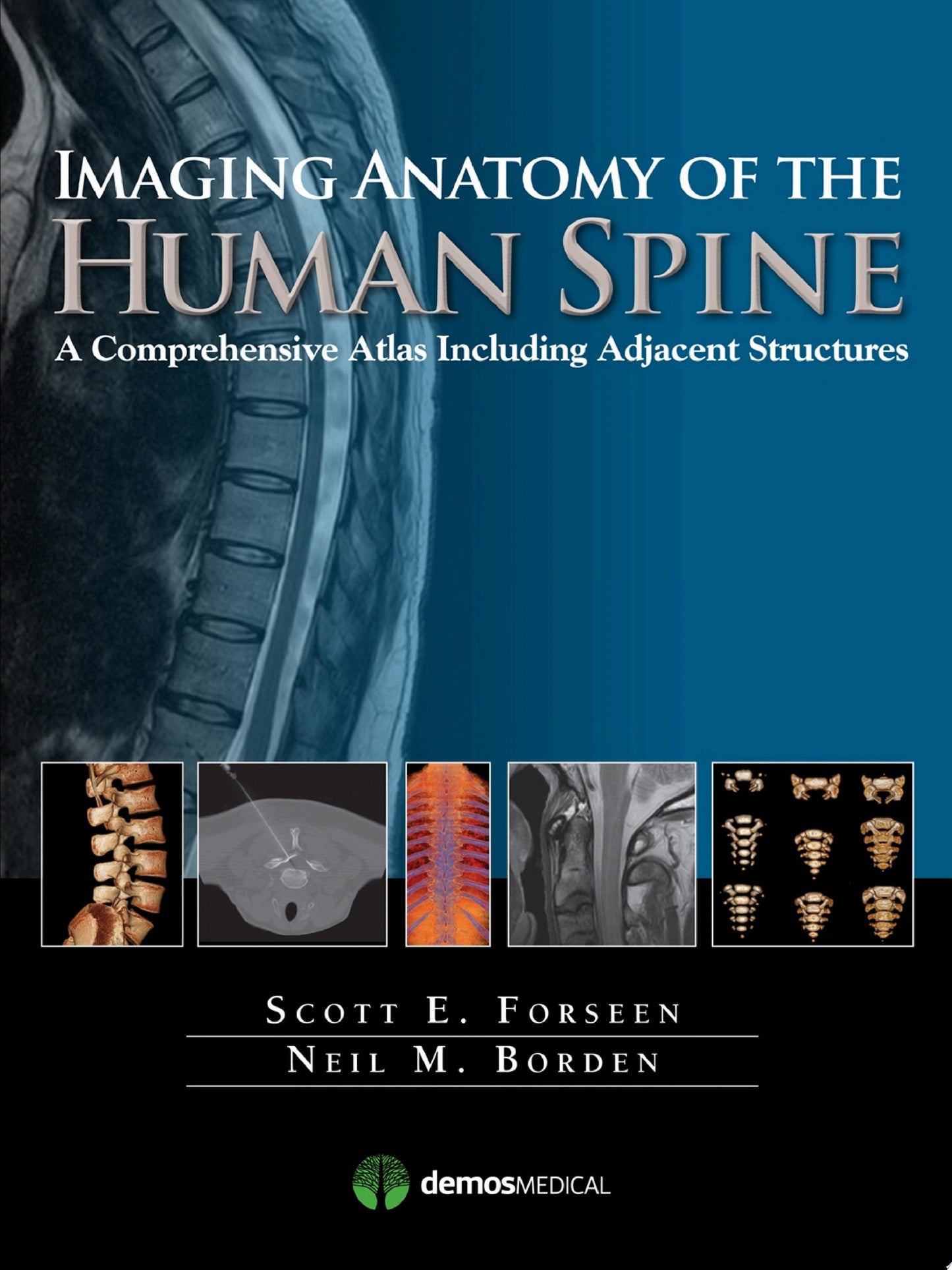 Imaging Anatomy of the Human Spine: A Comprehensive Atlas Including Adjacent Structures