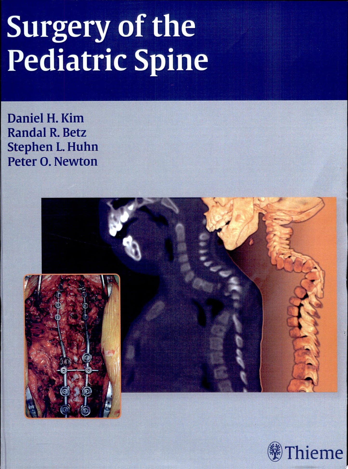Surgery of the Pediatric Spine
