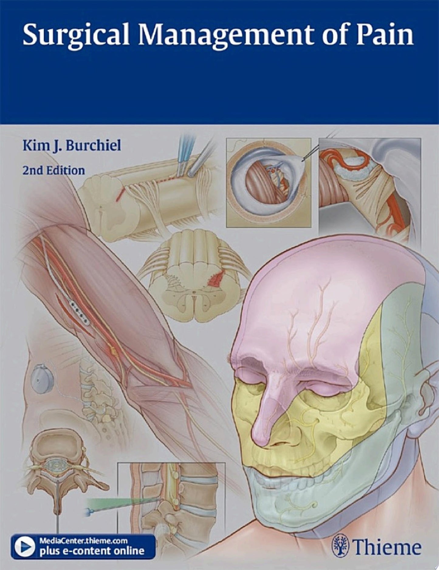 Surgical Management of Pain, 2nd Edition