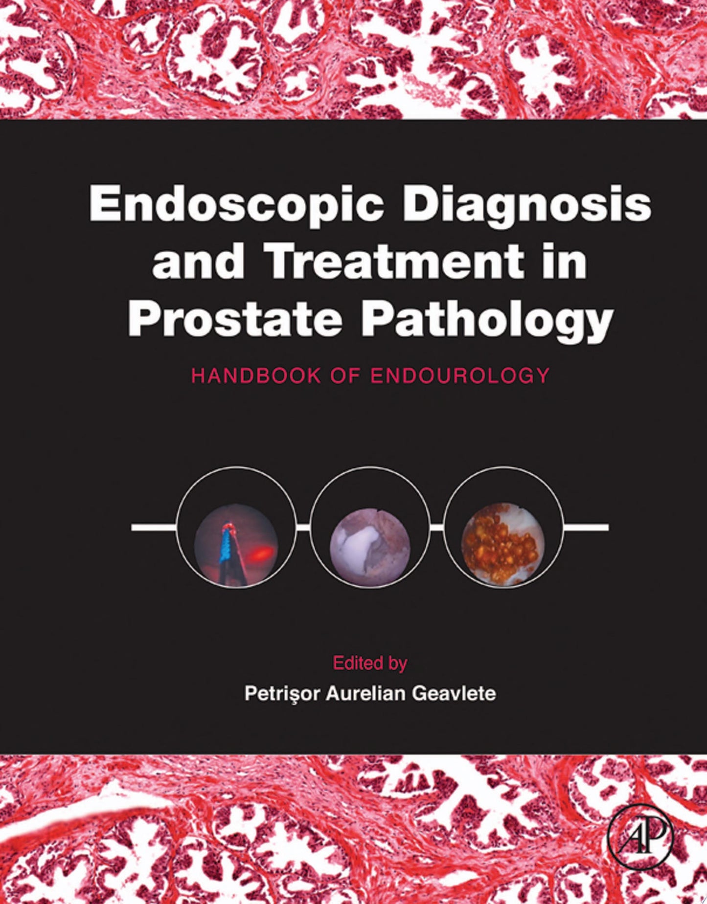 Endoscopic Diagnosis and Treatment in Prostate Pathology: Handbook of Endourology