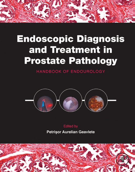 Endoscopic Diagnosis and Treatment in Prostate Pathology: Handbook of Endourology