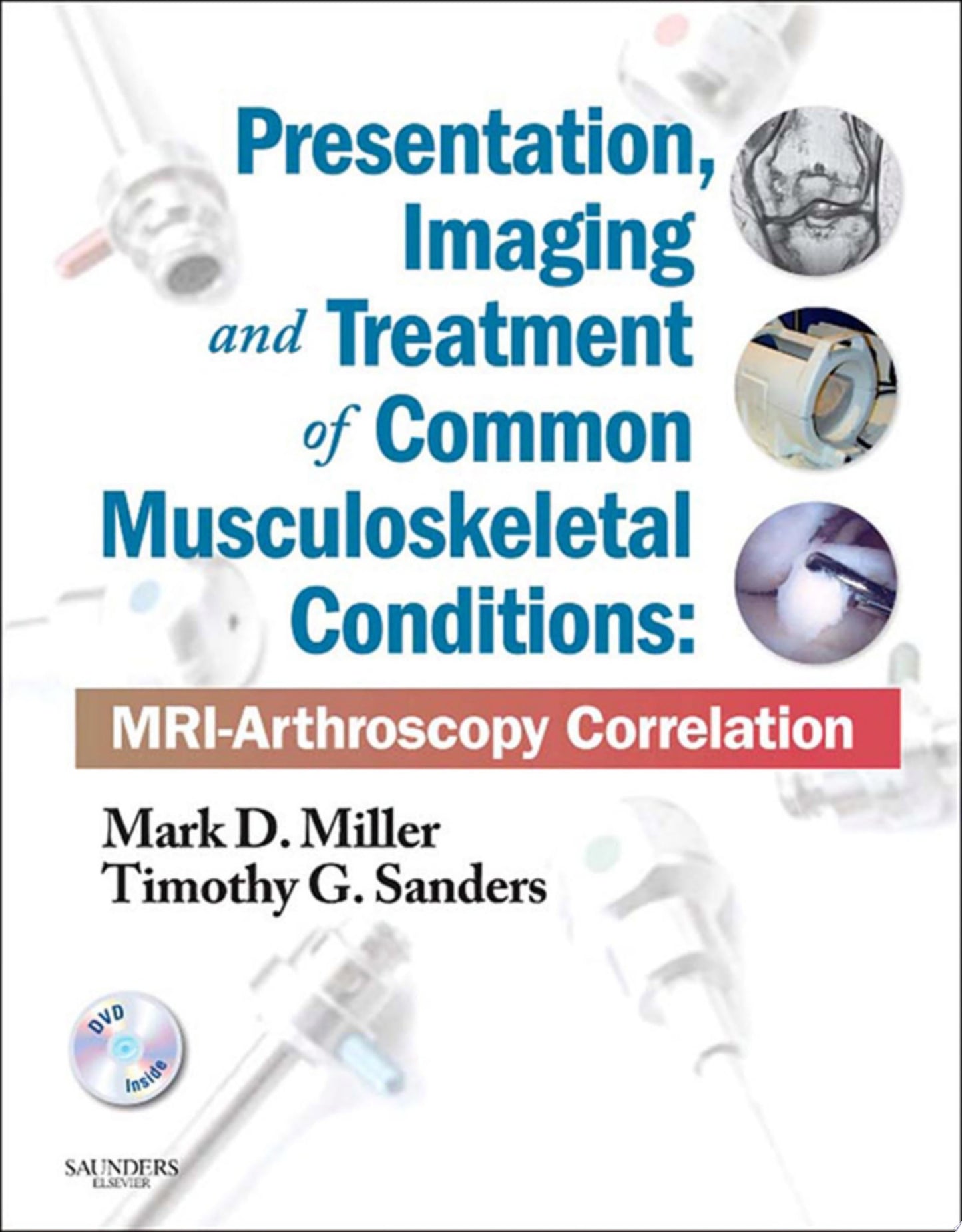 Presentation, Imaging and Treatment of Common Musculoskeletal Conditions: MRI-Arthroscopy Correlation