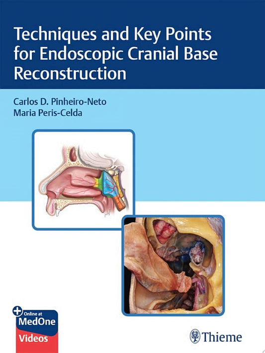 Techniques and Key Points for Endoscopic Cranial Base Reconstruction