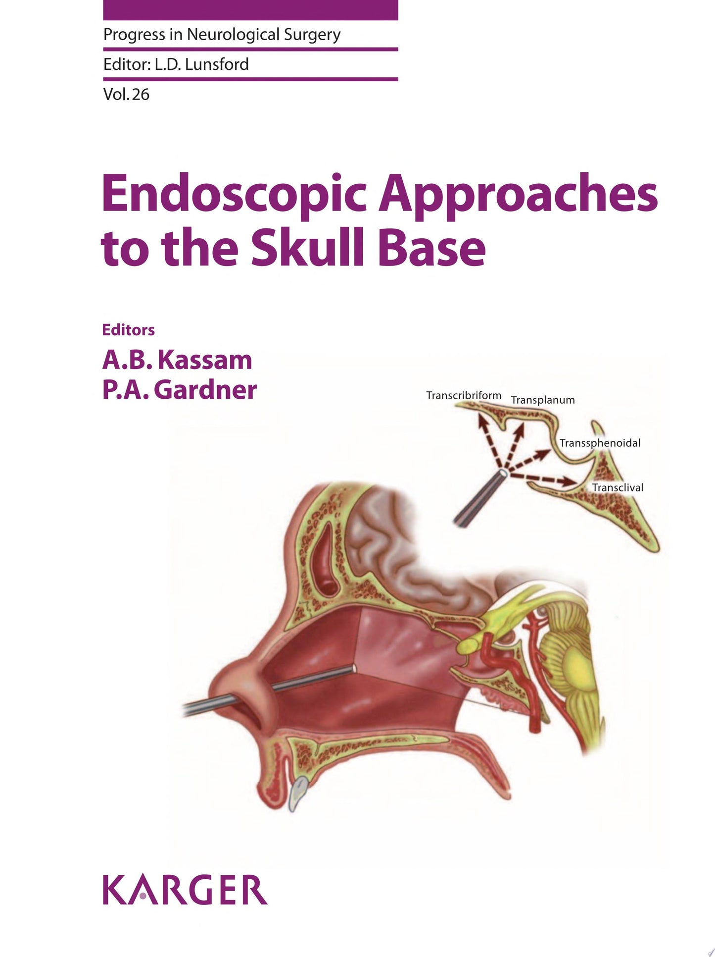 Endoscopic Approaches to the Skull Base
