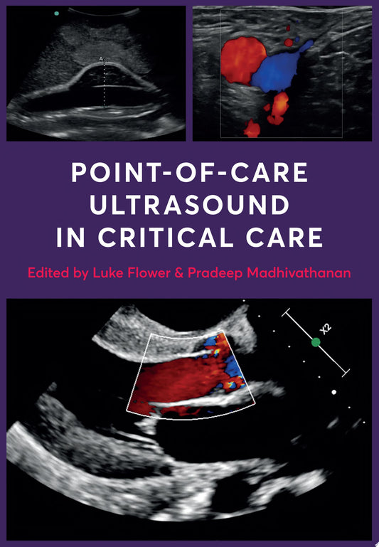 Point-of-Care Ultrasound in Critical Care