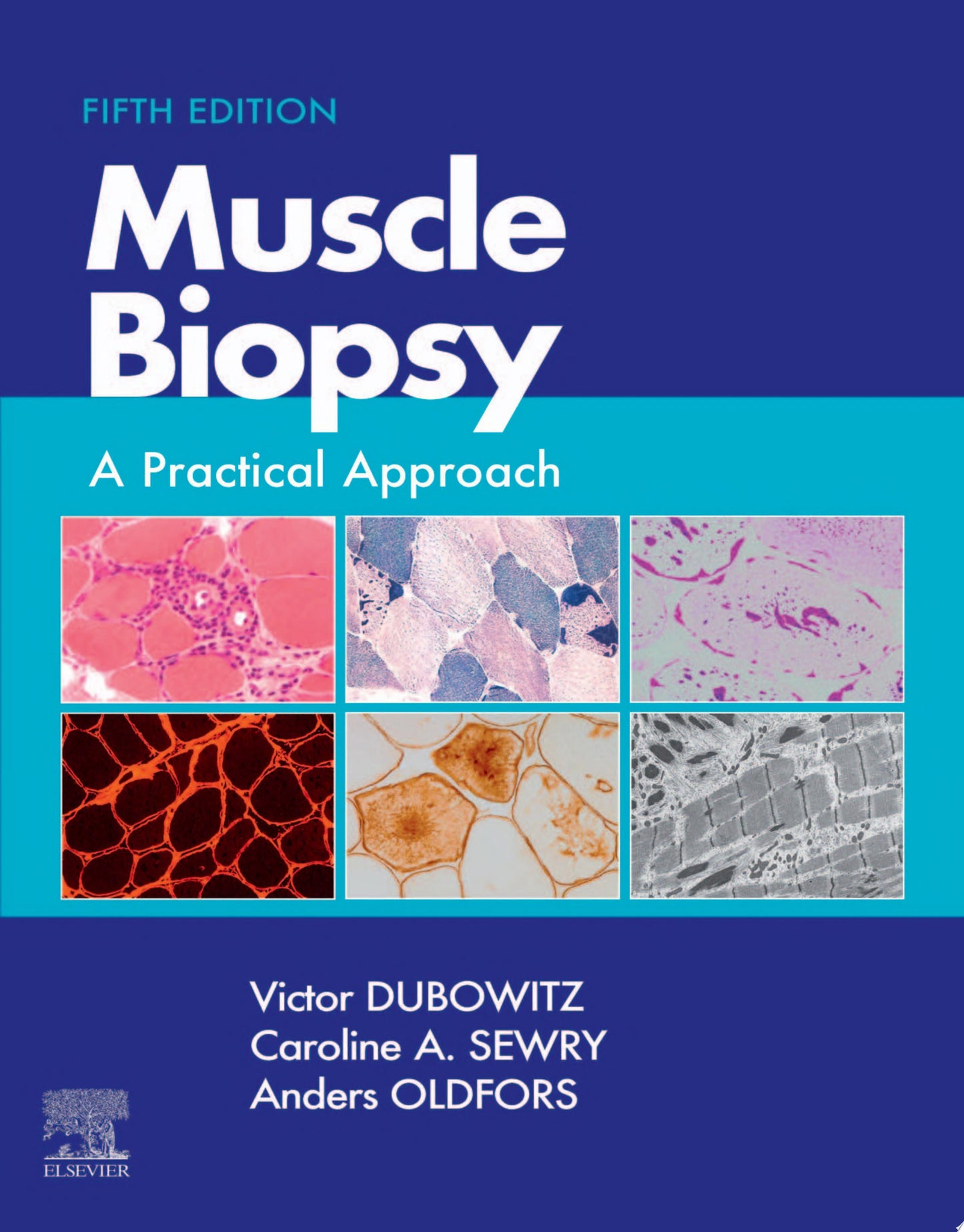 Muscle Biopsy: A Practical Approach, 4th Edition
