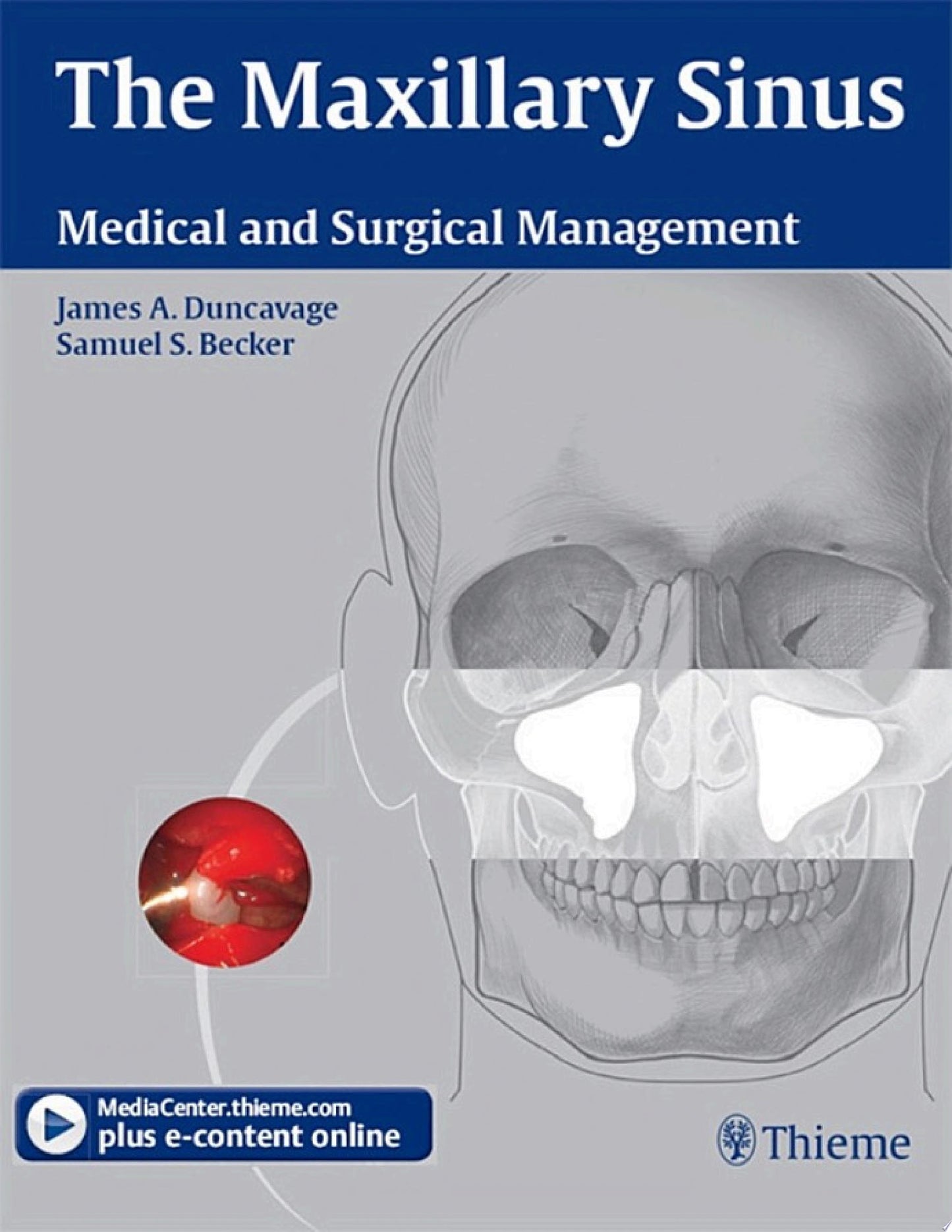 The Maxillary Sinus: Medical and Surgical Management