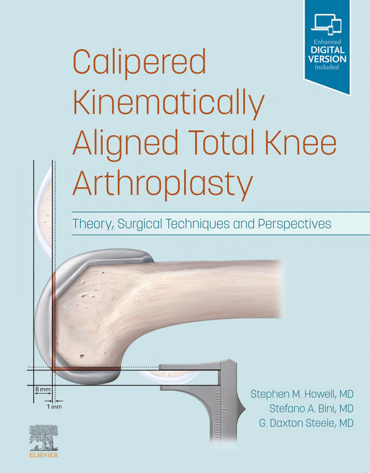 Calipered Kinematically aligned Total Knee Arthroplasty: Theory, Surgical Techniques and Perspectives