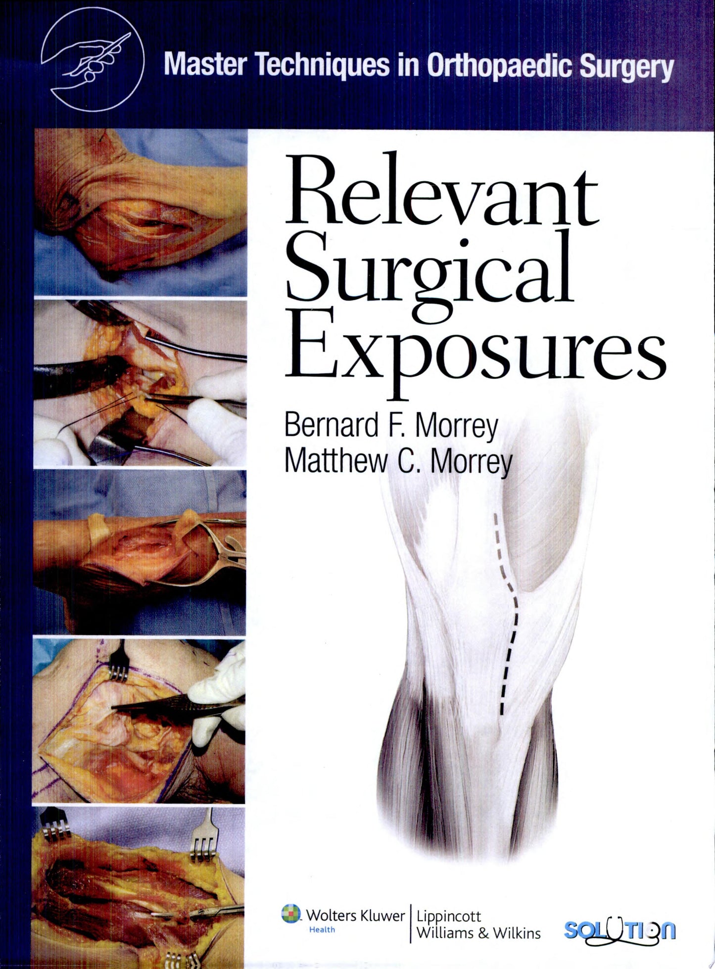 Orthopaedic Surgical Approaches, 2nd Edition (Copy)