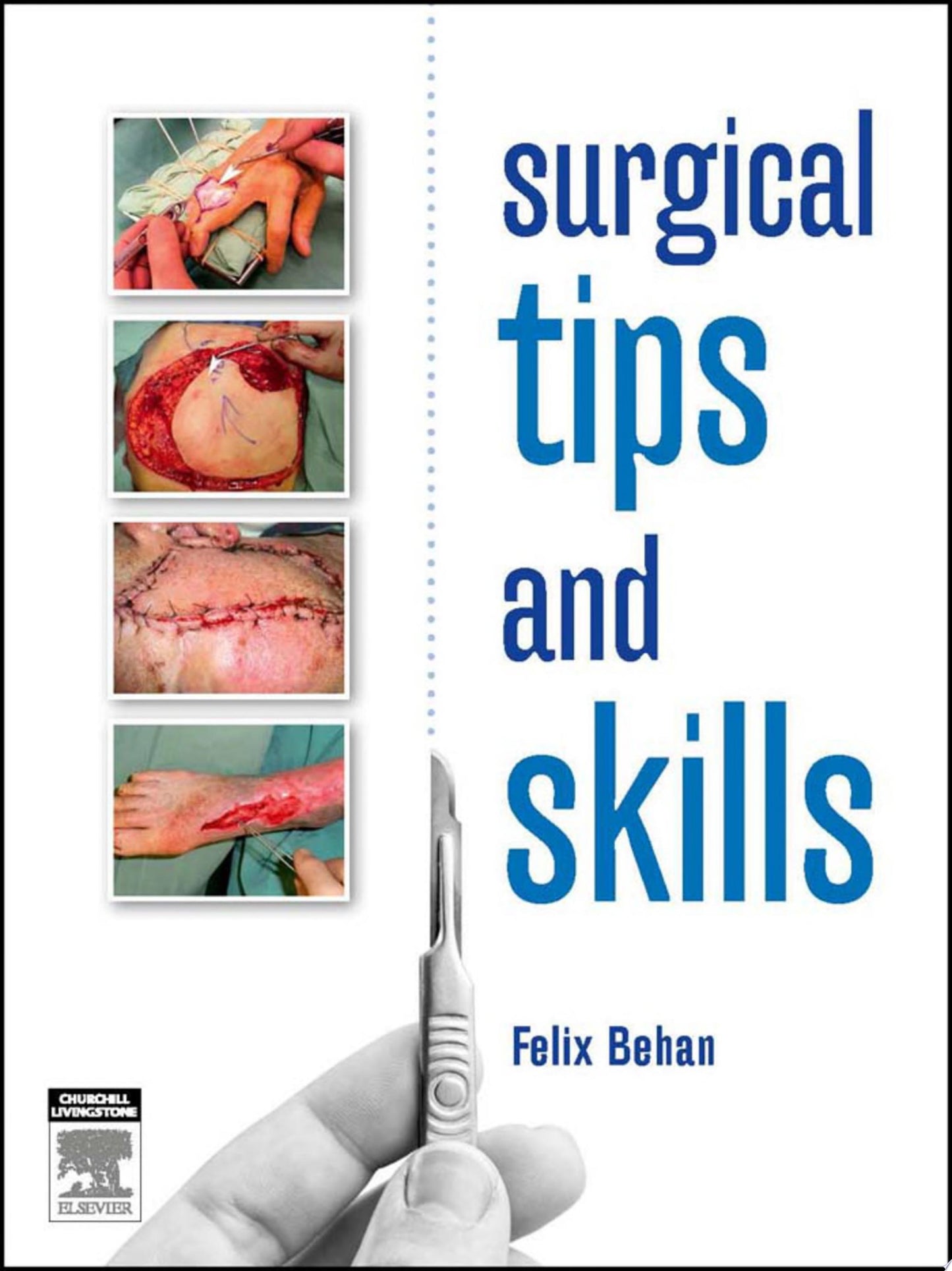 Surgical Tips and Skills