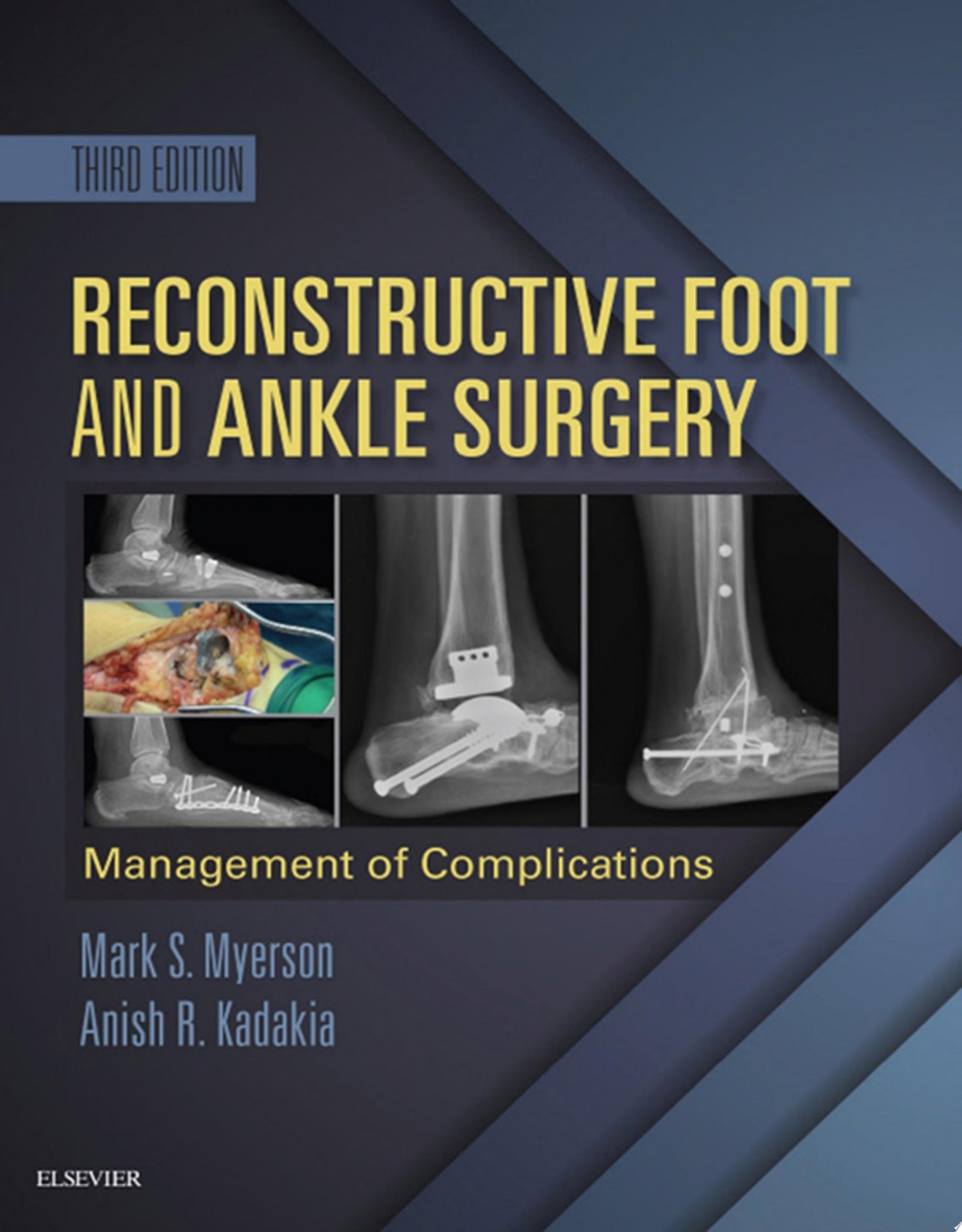 Reconstructive Foot and Ankle Surgery: Management of Complications, 3rd Edition