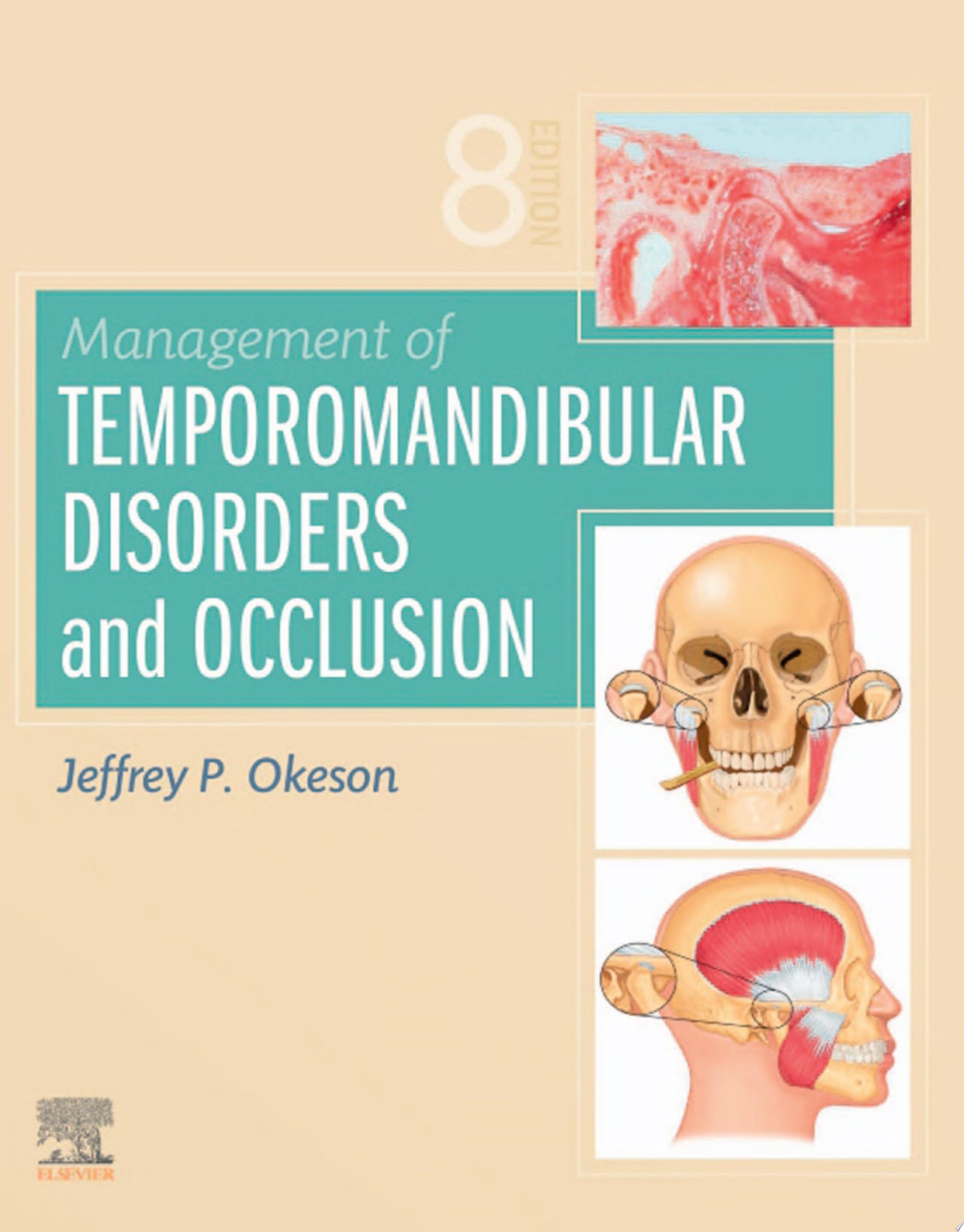 Management of Temporomandibular Disorders and Occlusion, 7th Edition