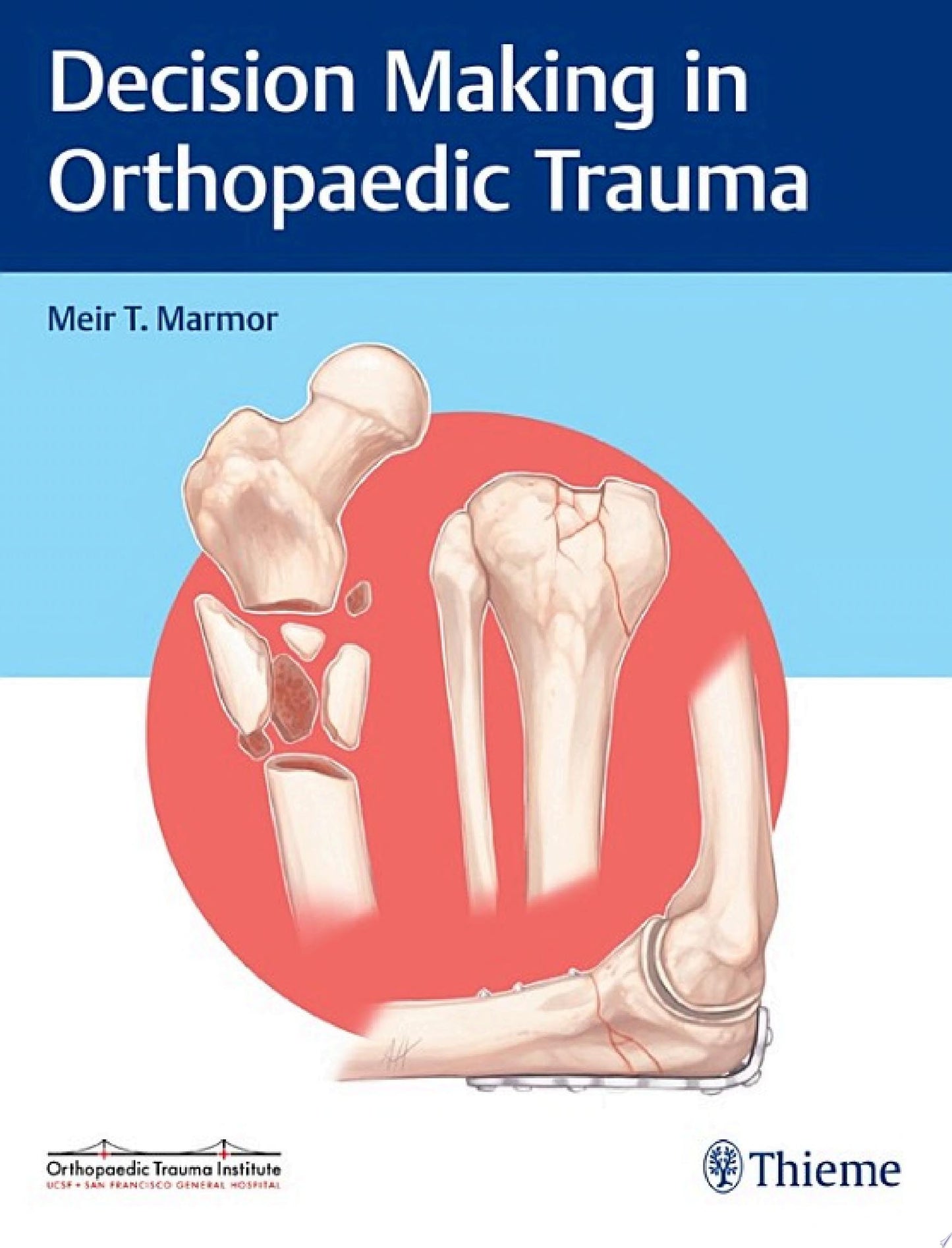 Decision Making in Orthopaedic Trauma, 1st edition