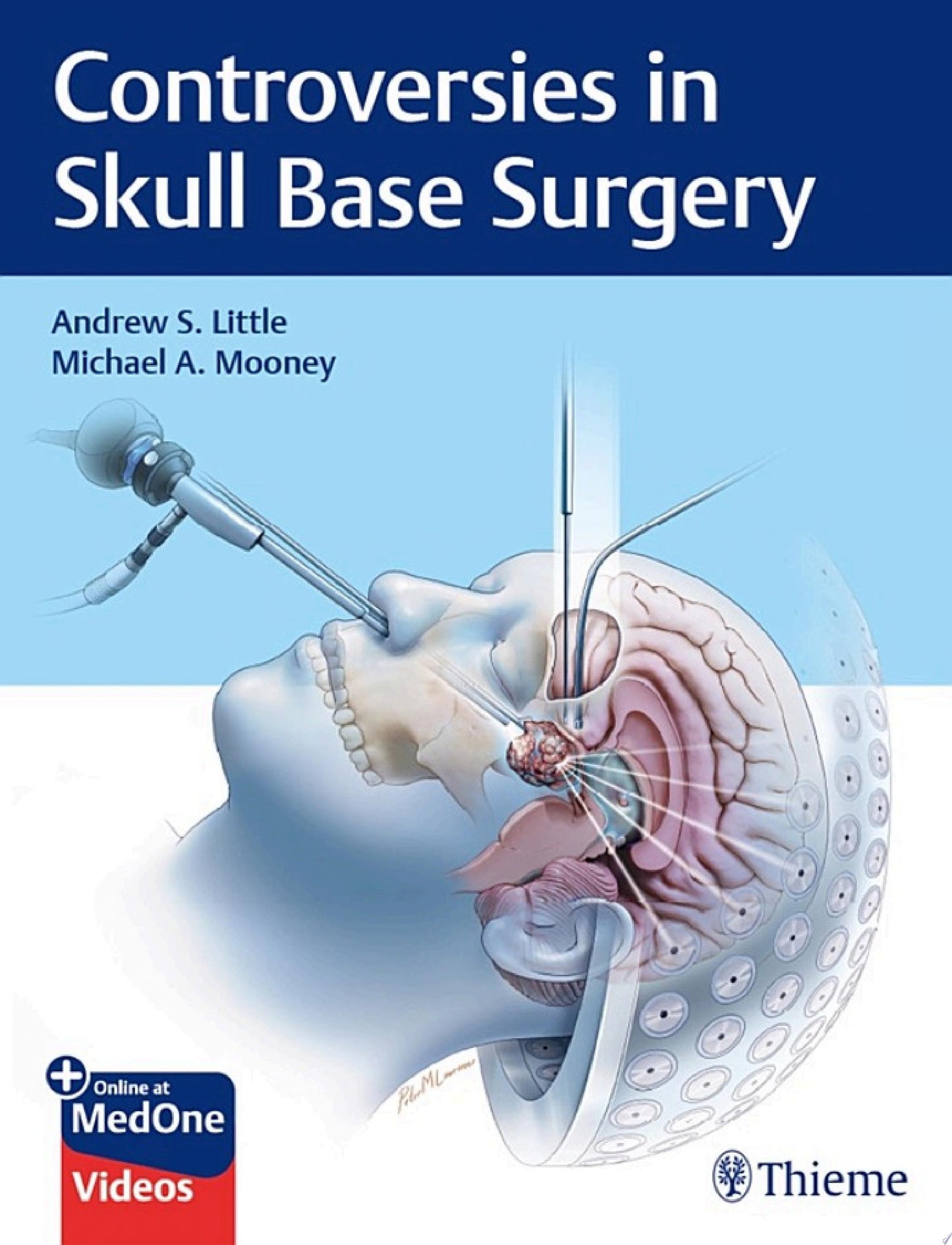 Controversies in Skull Base Surgery