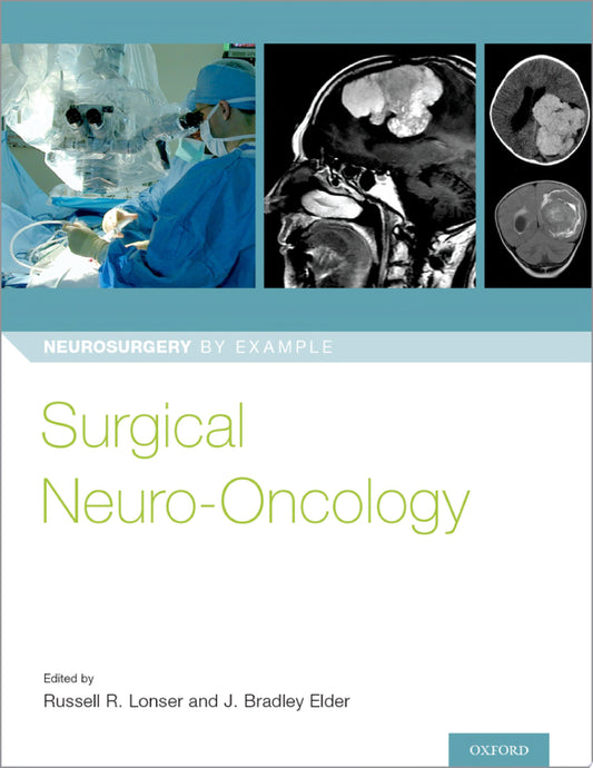 Surgical Neuro-Oncology