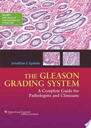 The Gleason Grading System: A Complete Guide for Pathologist and Clinicians