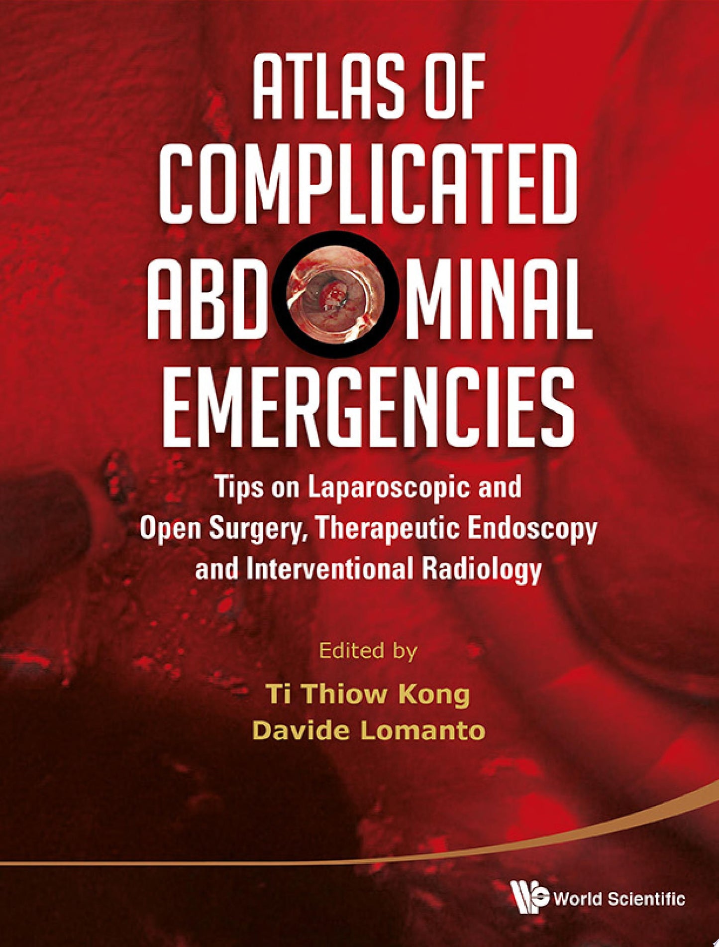 Atlas of Complicated Abdominal Emergencies: Tips on Laparoscopic and Open Surgery, Therapeutic Endoscopy and Interventional Radiology