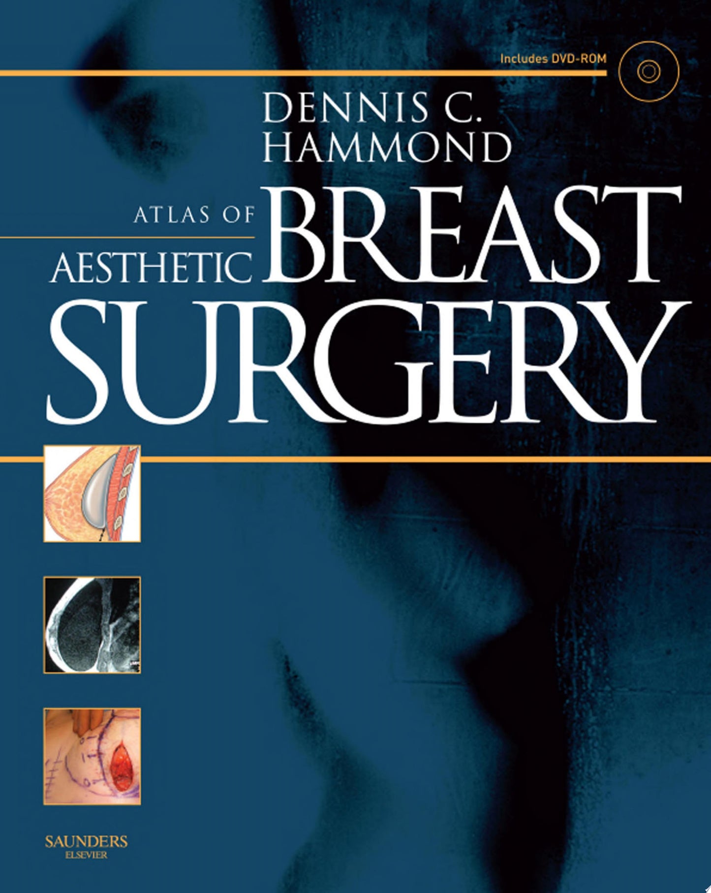 Atlas of Aesthetic Breast Surgery