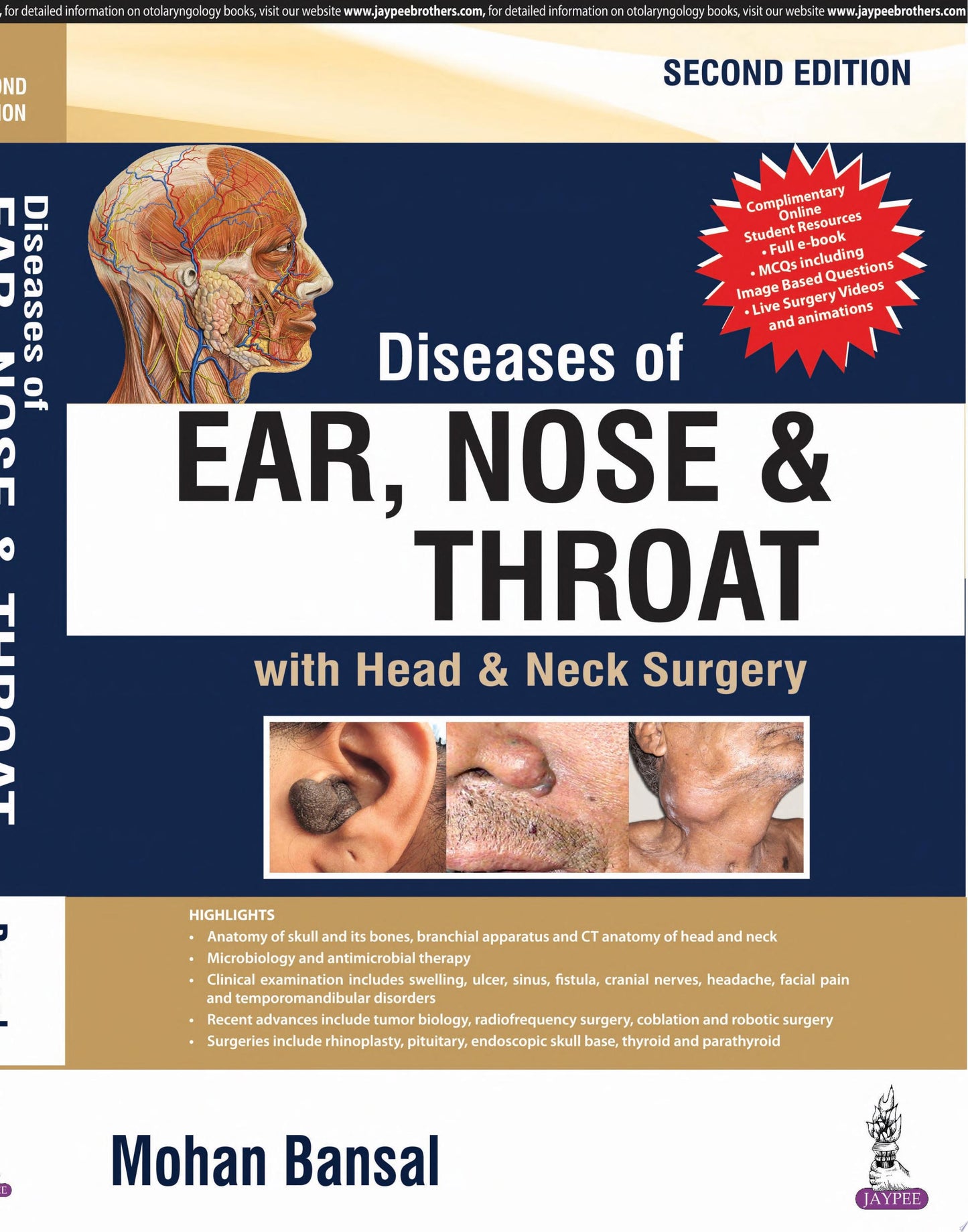 Diseases of Ear, Nose and Throat With Head and Neck Surgery, 2nd Edition