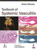 Textbook of Systemic Vasculitis, 2nd Edition