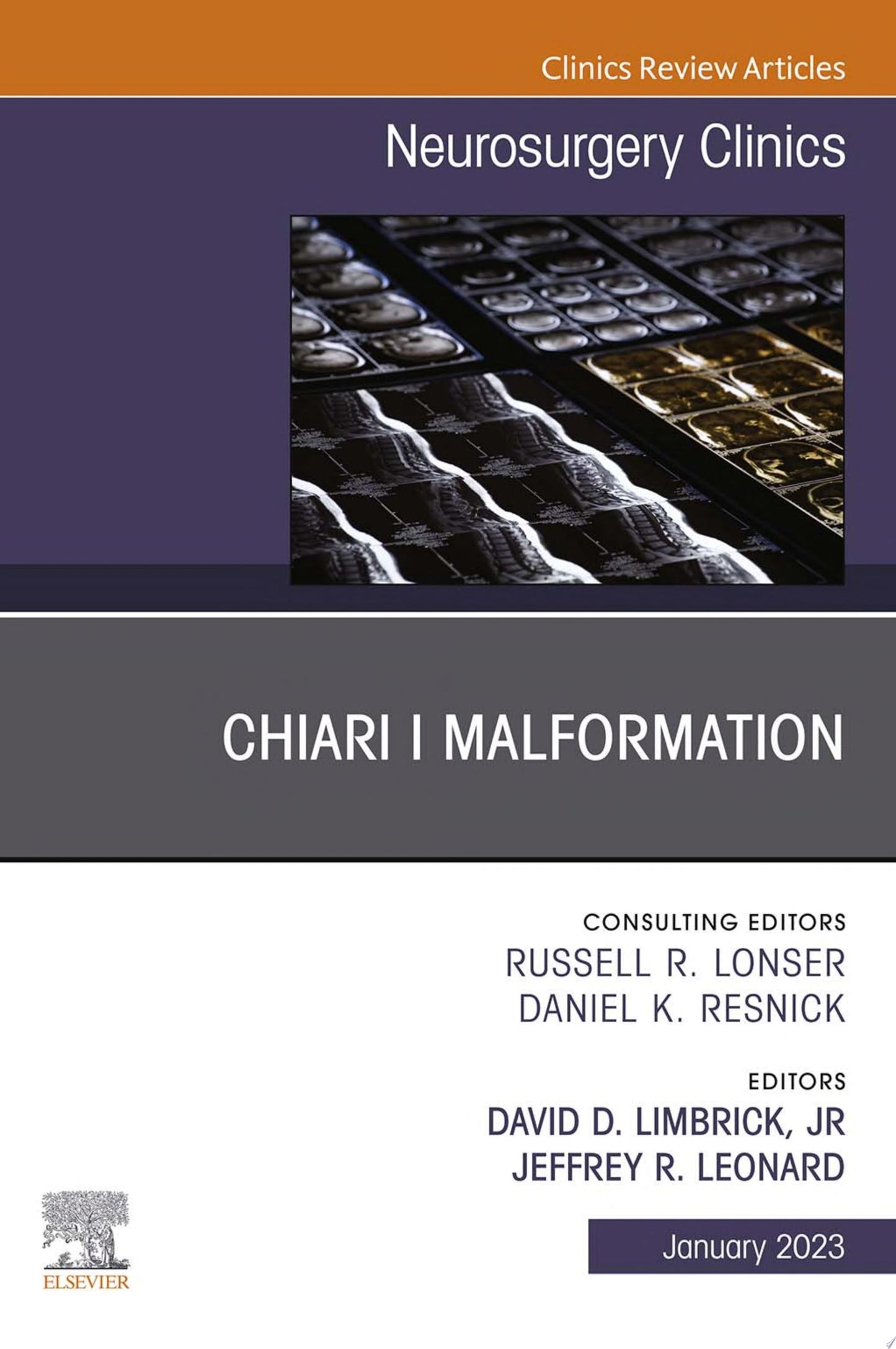 Chiari Malformation, An Issue of Neurosurgery Clinics of North America, 1e