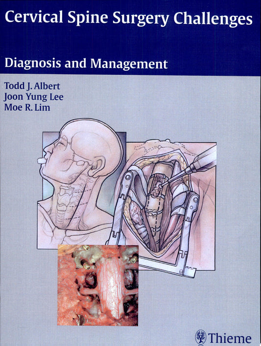 Cervical Spine Surgery Challenges: Diagnosis and Management