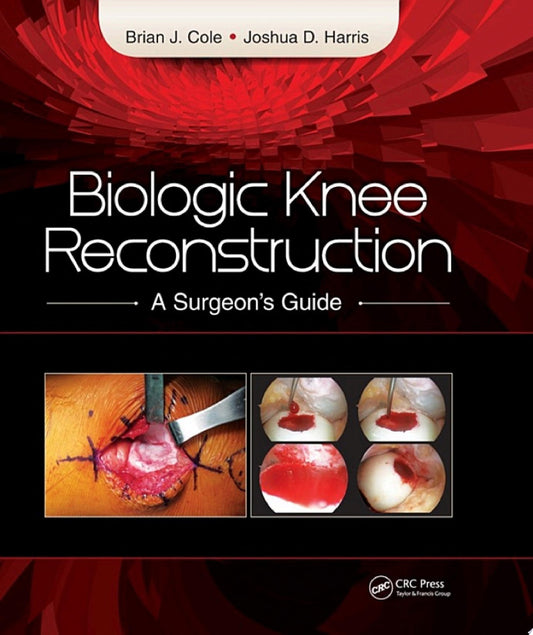 Biologic Knee Reconstruction: A Surgeon’s Guide