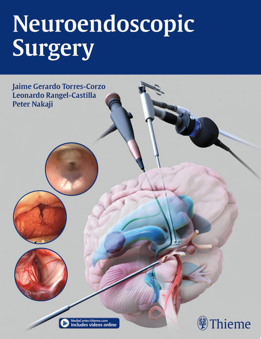 Neuroendoscopic Surgery