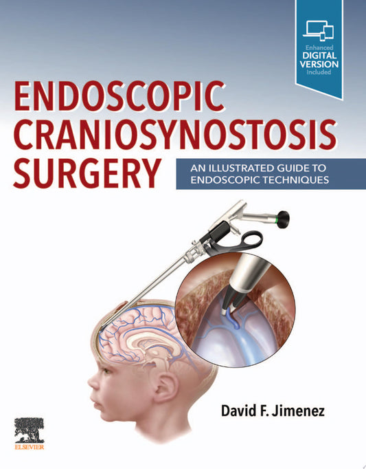 Endoscopic Craniosynostosis Surgery: An Illustrated Guide to Endoscopic Techniques