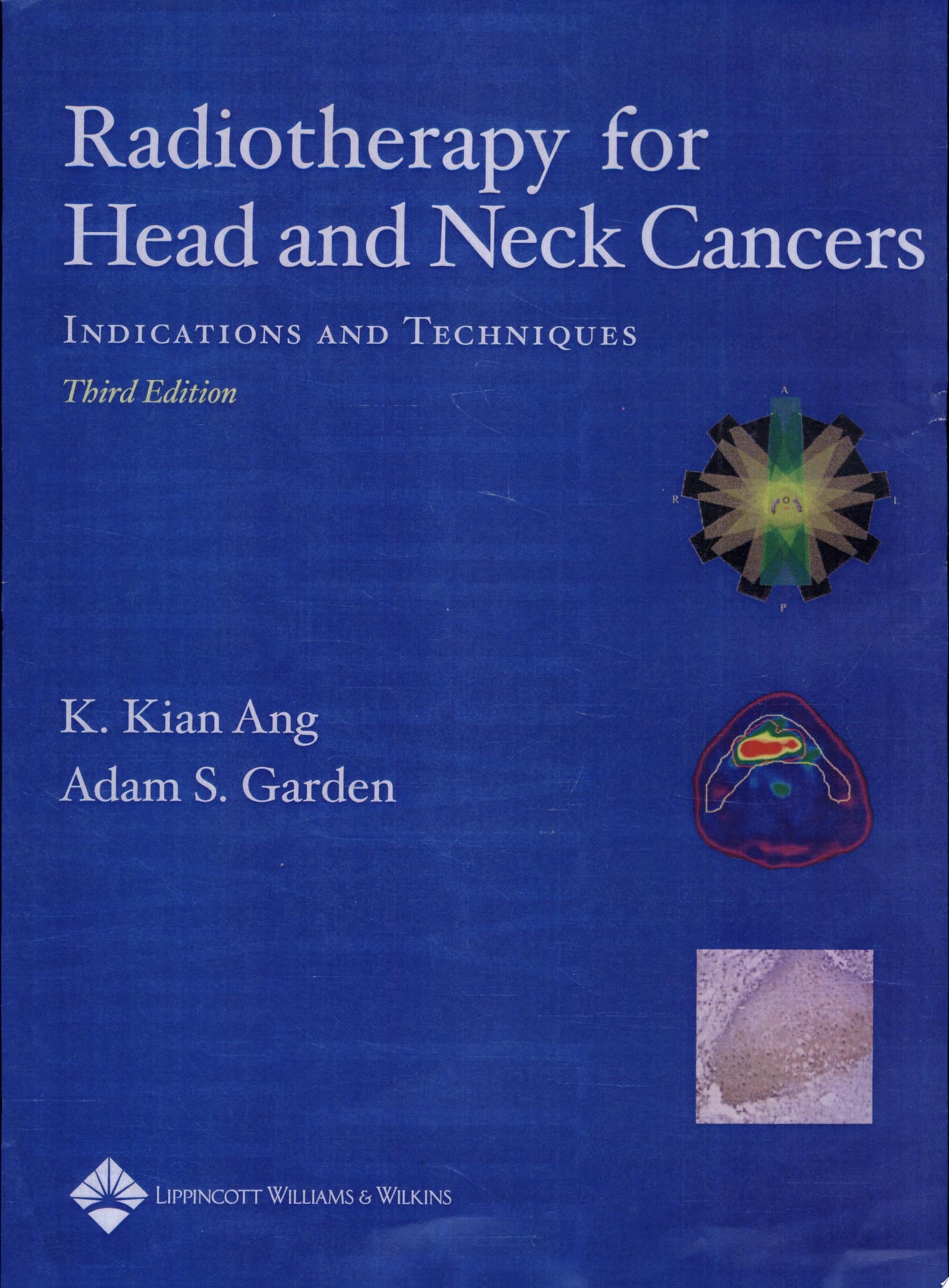 Radiotherapy for Head and Neck Cancers: Indications and Techniques